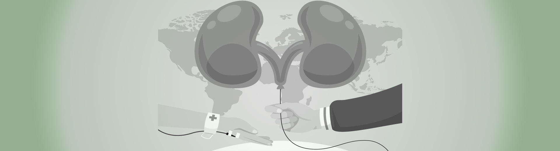 Kidney Transplantation Services when patient qualifies for a Kidney Transplant Kidney Transplantation Services in Pietermaritzburg by Dr Nonkala