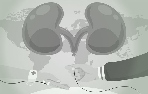 Services for the management of the entire kidney transplant process