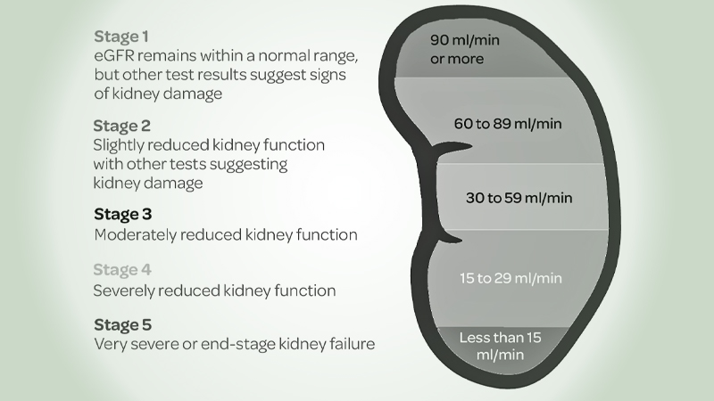 Progression of Kidney Disease based on eGFR